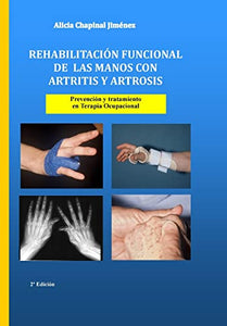 Rehabilitacion funcional de las manos con artritis y artrosis 