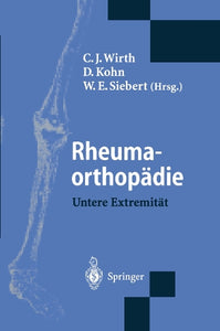 Rheumaorthopädie — Untere Extremität 